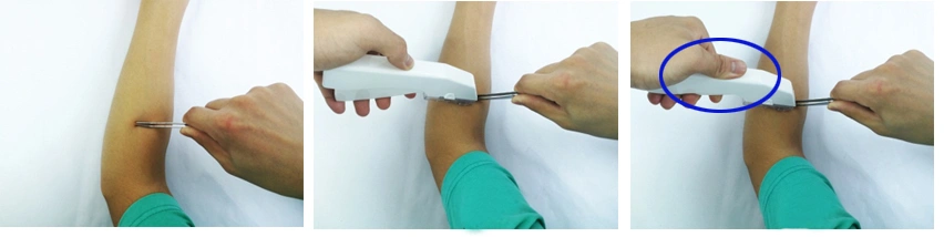 Grampeadores da pele médica descartável e removedores cirúrgicos do grampeador com CE